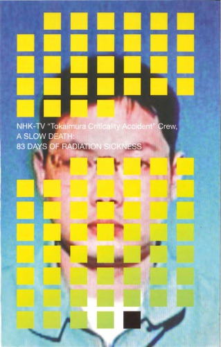 A Slow Death 83 Days Of Radiation Sickness Reprint Nhk Tv Crew