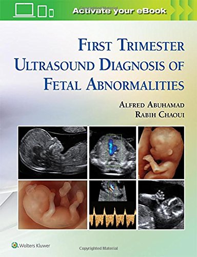 First Trimester Ultrasound Diagnosis Of Fetal Abnormalities Alfred Z Abuhamad
