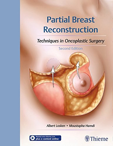 Partial Breast Reconstruction Techniques In Oncoplastic Surgery 2nd Edition Albert Losken