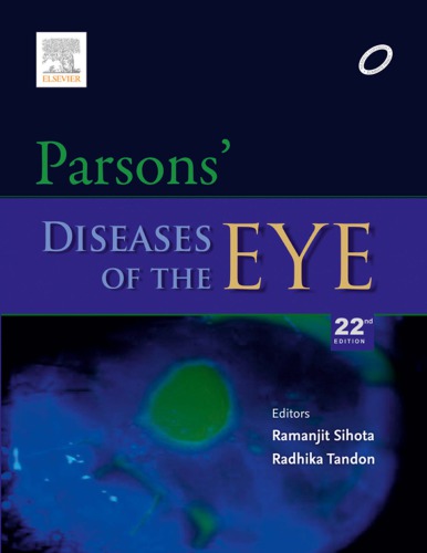 Parsons Diseases Of The Eye 22th Edition Ramanjit Sihota Radhika Tandon