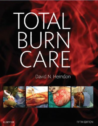 Total Burn Care 5th David N Herndon