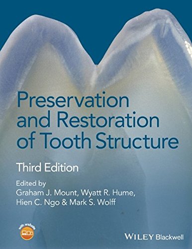 Preservation And Restoration Of Tooth Structure 3rd Edition Graham J Mount Et Al Eds