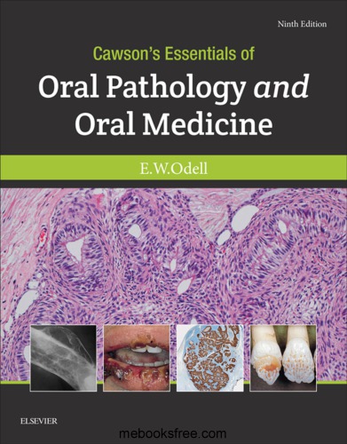 Cawsons Essentials Of Oral Pathology And Oral Medicine 9th Edition Ewodell