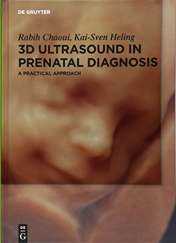 3d Ultrasound In Prenatal Diagnosis A Practical Approach 1st Edition Rabih Chaoui