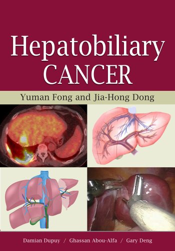 Hepatobiliary Cancer 1st Yuman Fong Jiahong Dong