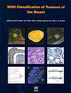 Who Classification Of Tumours Of The Breast Lakhani Sunil R