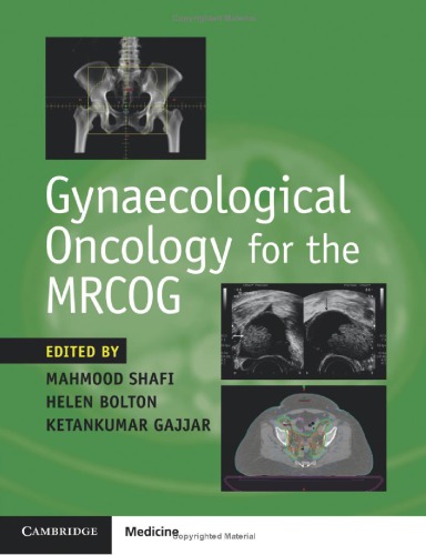 Gynaecological Oncology For The Mrcog Mahmood Shafi Helen Bolton