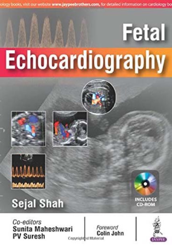Fetal Echocardiography 1st Sejal Shah Editor Sunita Maheshwari Editor