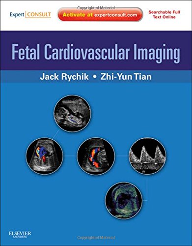 Fetal Cardiovascular Imaging A Disease Based Approach 1st Jack Rychik