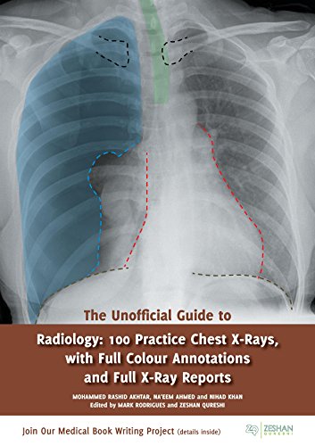 The Unofficial Guide To Radiology 1st Coll