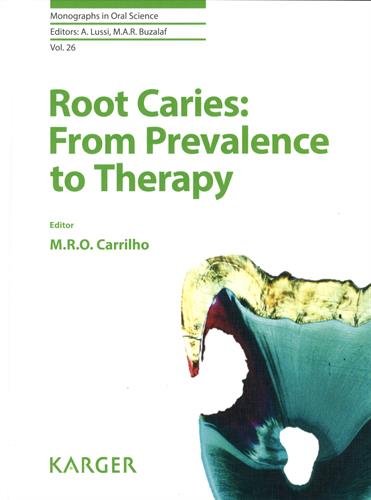Root Caries From Prevalence To Therapy 1st Edition M Rocha De Olivera Carrilho