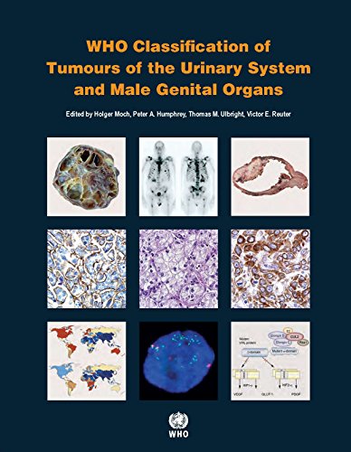 Who Classification Of Tumours Of The Urinary System And Male Genital Organs 4th Edition Coll
