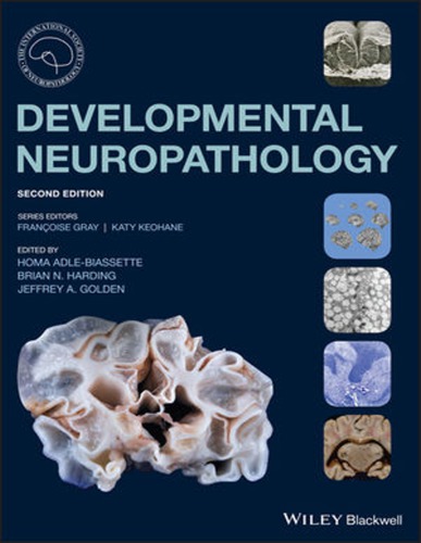 Developmental Neuropathology Second Edition Adlebiassette Homa Golden