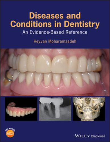 Diseases And Conditions In Dentistry An Evidencebased Reference Moharamzadeh