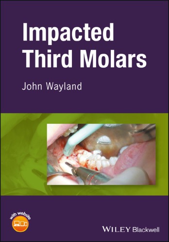 Impacted Third Molars Wayland John