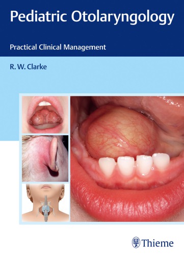 Pediatric Otolaryngology Practical Clinical Management R W Clarke