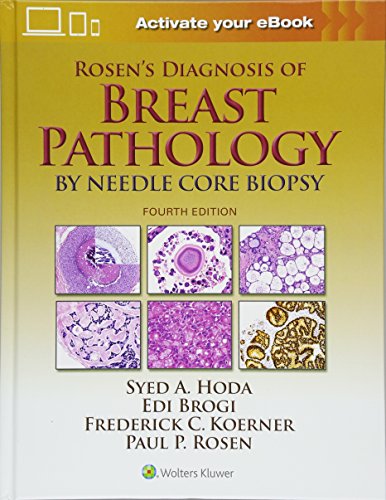 Rosens Diagnosis Of Breast Pathology By Needle Core Biopsy 4th Syed A Hoda Et Al