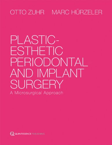 Plasticesthetic Periodontal And Implant Surgery A Microsurgical Approach 1st Edition Otto Zuhr