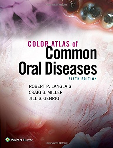 Color Atlas Of Common Oral Diseases Fifth Robert Langlais Craig Miller