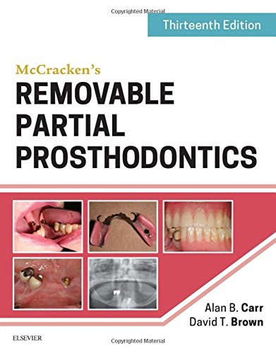 Mccrackens Removable Partial Prosthodontics 13e 13th Edition Alan B Carr Dmd Ms