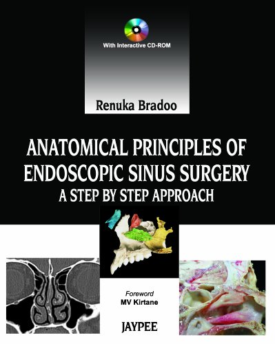 Anatomical Principles Of Endoscopic Sinus Surgery 1st Edition Bradoo