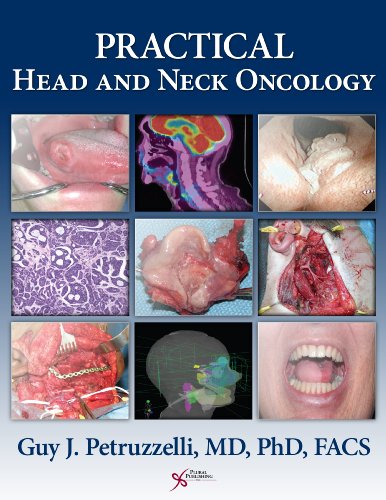 Practical Head And Neck Oncology 1st Edition Guy J Petruzzelli