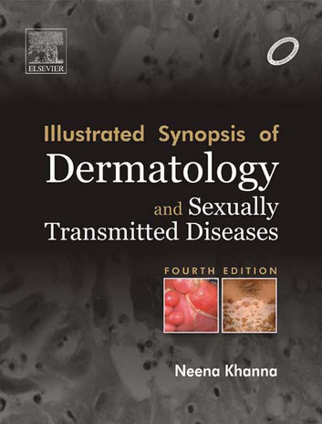 Illustrated Synopsis Of Dermatology And Sexually Transmitted Diseases 4th Elsevier India