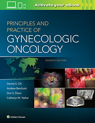 Principles And Practice Of Gynecologic Oncology Seventh Dennis Chi