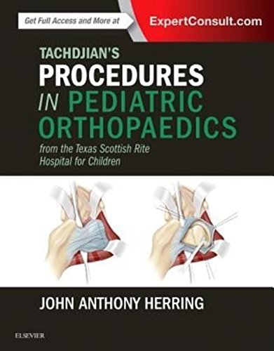 Tachdjians Procedures In Pediatric Orthopaedics From The Texas Scottish Rite Hospital For Children 1st Edition John A Herring