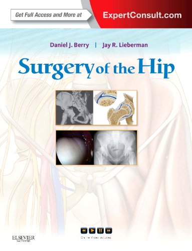 Surgery Of The Hip Expert Consult Daniel J Berry Jay Lieberman