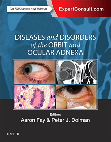 Diseases And Disorders Of The Orbit And Ocular Adnexa 1st Edition Aaron Fay
