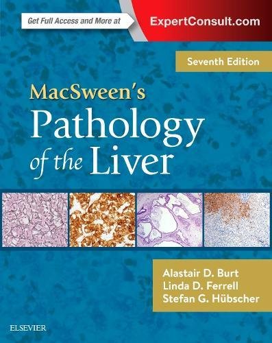 Macsweens Pathology Of The Liver 7th Edition Alastair D Burt