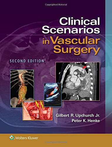 Clinical Scenarios In Vascular Surgery Second Gilbert R Upchurch Jr Md