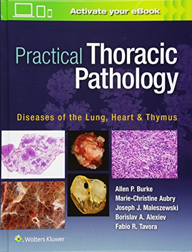 Practical Thoracic Pathology Diseases Of The Lung Heart And Thymus First Allen P Burke