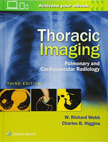 Thoracic Imaging Pulmonary And Cardiovascular Radiology Third W Richard Webb