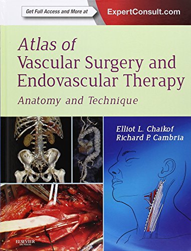 Atlas Of Vascular Surgery And Endovascular Therapy Anatomy And Technique 1st Edition Elliot L Chaikof