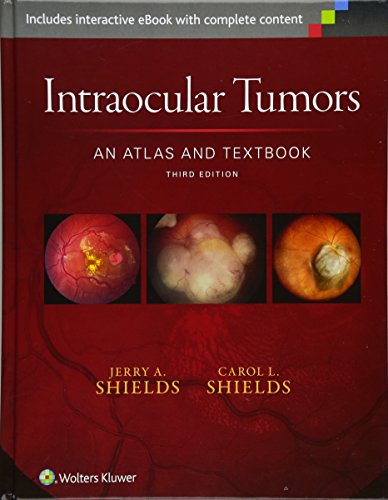 Intraocular Tumors An Atlas And Textbook Third Dr Jerry A Shields