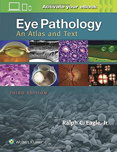 Eye Pathology An Atlas And Text Third Ralph C Eagle Jr Md