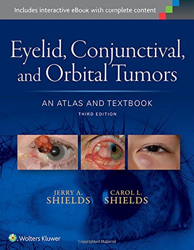 Eyelid Conjunctival And Orbital Tumors An Atlas And Textbook 3rd Jerry A Shields