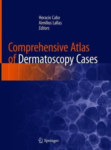 Comprehensive Atlas Of Dermatoscopy Cases 1st Ed 2018 Horacio Cabo