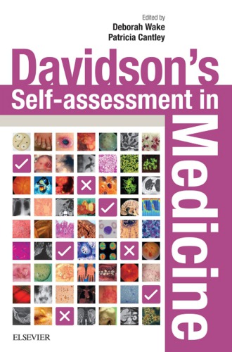 Davidsons Selfassessment In Medicine 1st Edition Deborah Wake