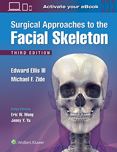 Surgical Approaches To The Facial Skeleton Third Edward Ellis Iii Dds