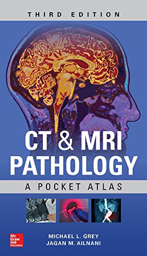 Ct Mri Pathology A Pocket Atlas 3d Michael L Grey Jagan Mohan Ailinani