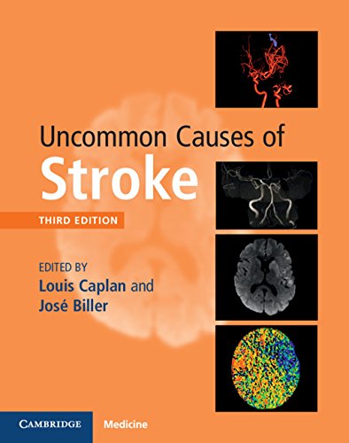 Uncommon Causes Of Stroke 3rd Edition Louis Caplan Jos Biller