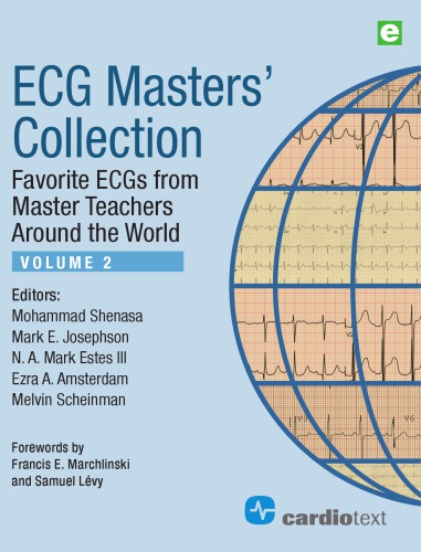 Ecg Masters Collection Favorite Ecgs From Master Teachers Around The World Mohammad Shenasa