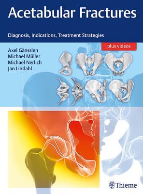 Acetabular Fractures Diagnosis Indications Treatment Strategies Hardcover Axel Gnsslen Michael Mller Michael Nerlich