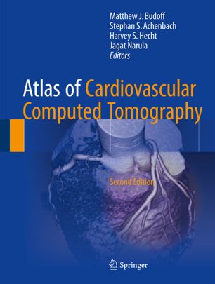 Atlas Of Cardiovascular Computed Tomography 2nd Ed Matthew J Budoff