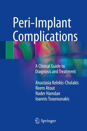 Periimplant Complications 1st Ed Anastasia Kelekischolakis