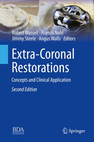 Extracoronal Restorations 2nd Ed Robert Wassell Francis Nohl