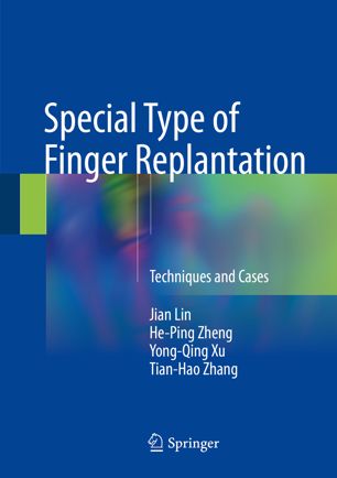 Special Type Of Finger Replantation 1st Ed Jian Lin Heping Zheng